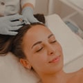 The Ultimate Guide to Using Exosomes for Facial Rejuvenation