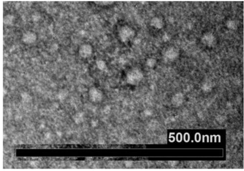 The Dual Nature of Exosomes: Harmful or Beneficial?