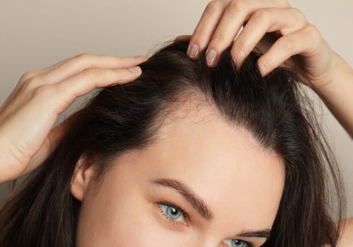 The Truth About Exosomes for Hair: Are They Really Permanent?