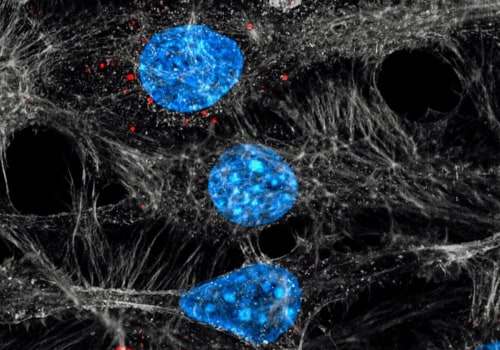 The Role of Exosomes in Cancer: A Comprehensive Review